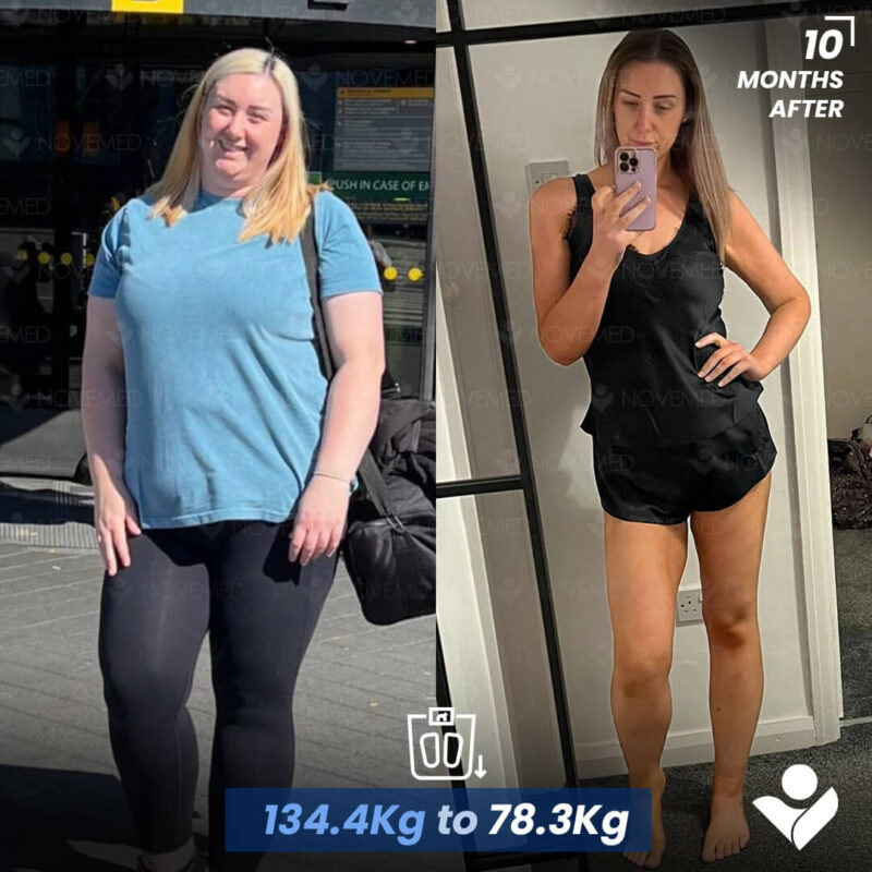 B&A1 (2)