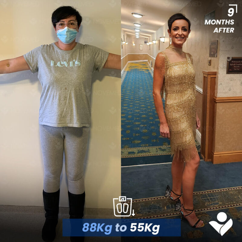 B&A4 (2)