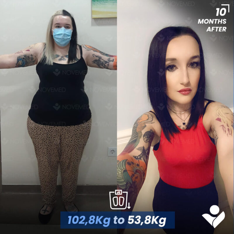 B&A5 (2)